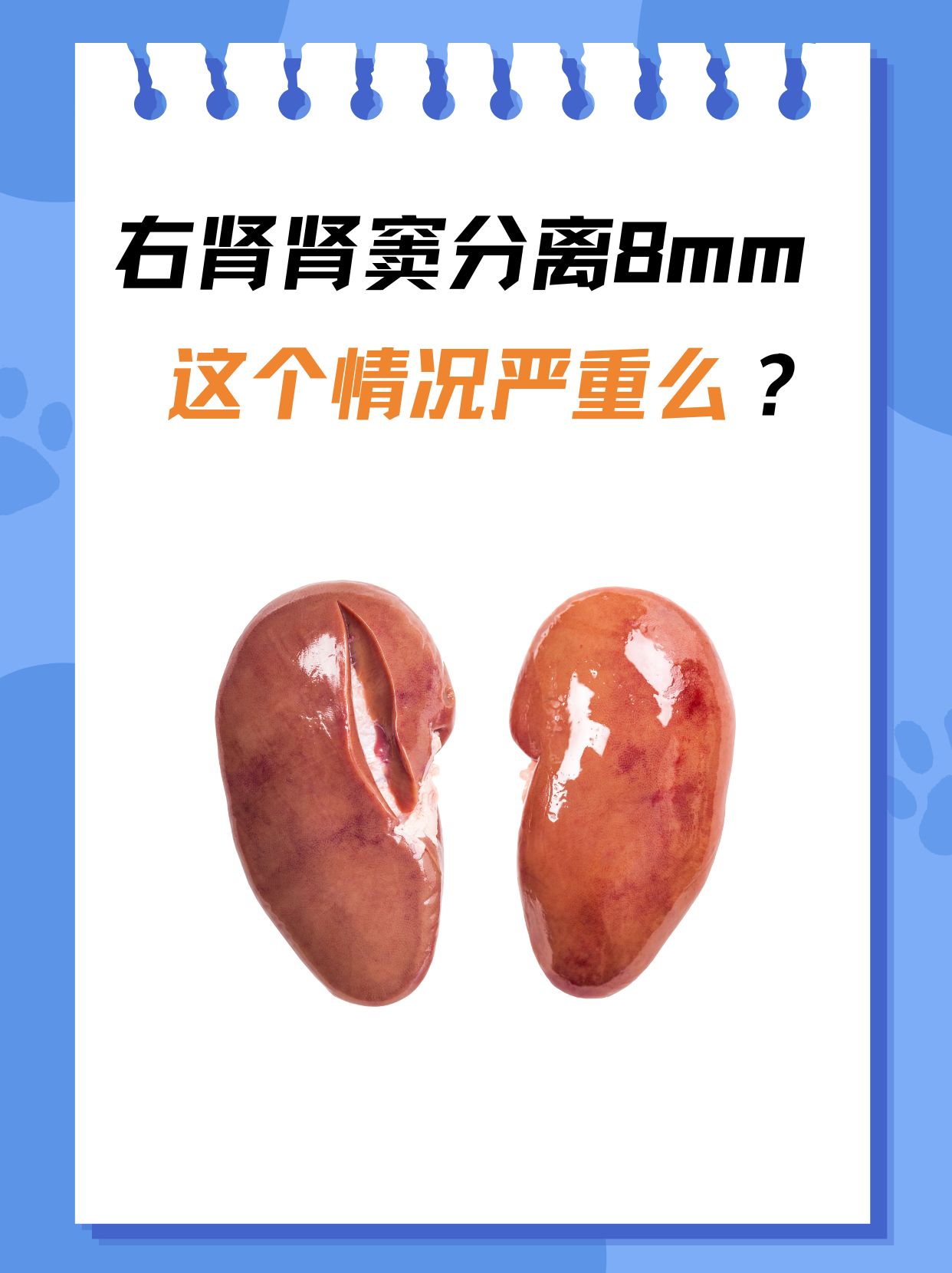 窦分离8mm时,许多人会心中一惊,担心这是否意味着肾脏出现了严重问题