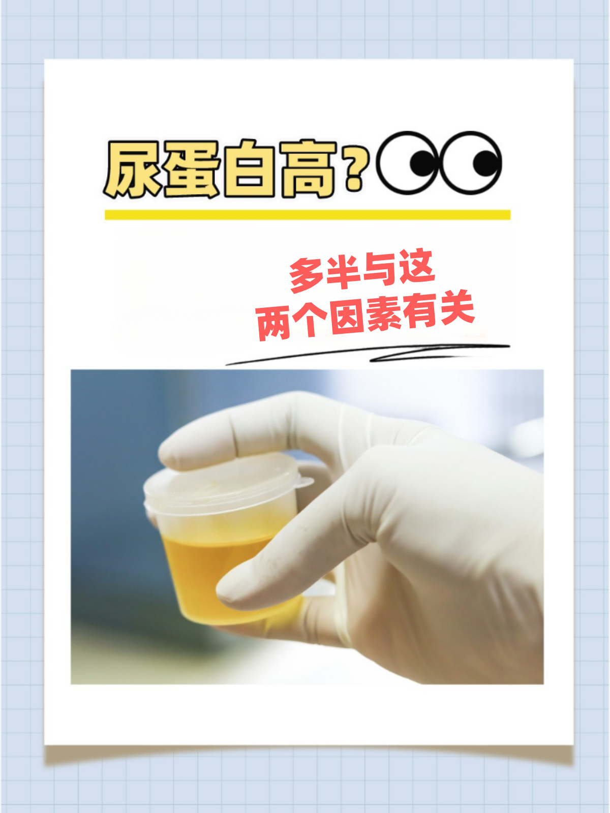 为什么要检查铜蓝蛋白