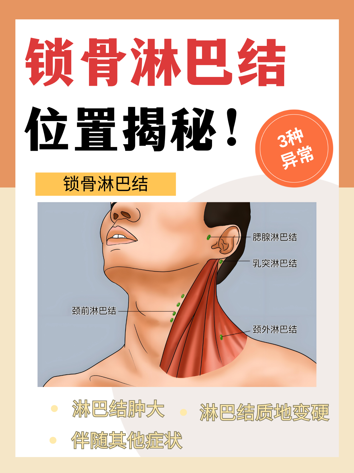 锁骨淋巴结,通常指的是锁骨上淋巴结,其具体位置及需要警惕的异常