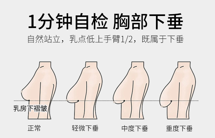 胸为什么会下垂