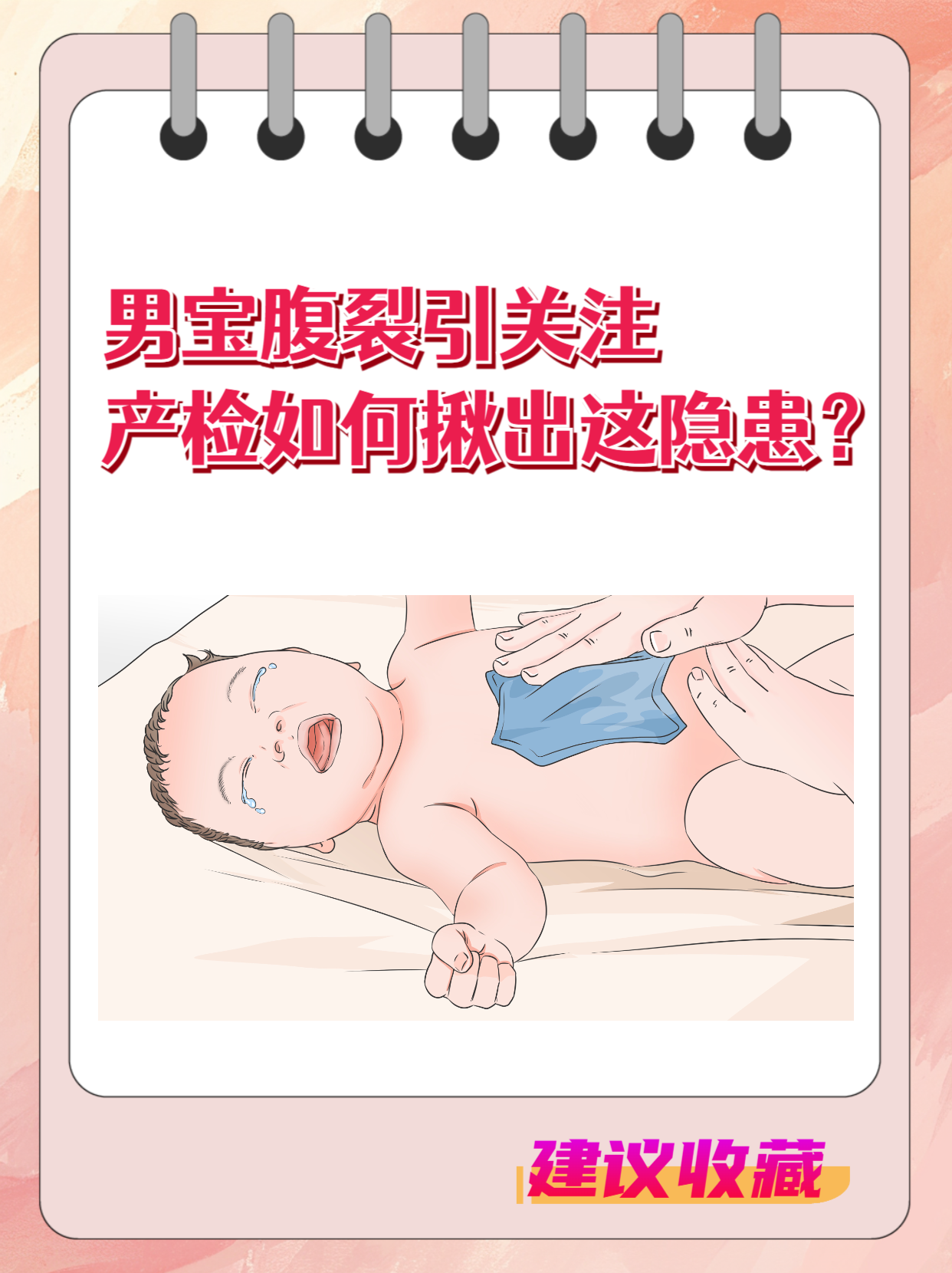 男宝腹裂引关注,产检如何揪出这隐患?