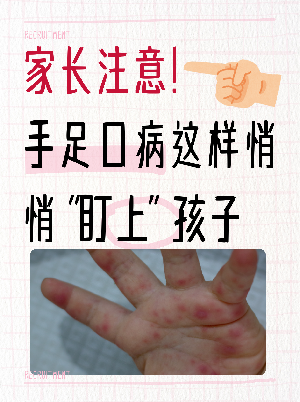 要有效预防手足口病,了解它的传播途径是关键