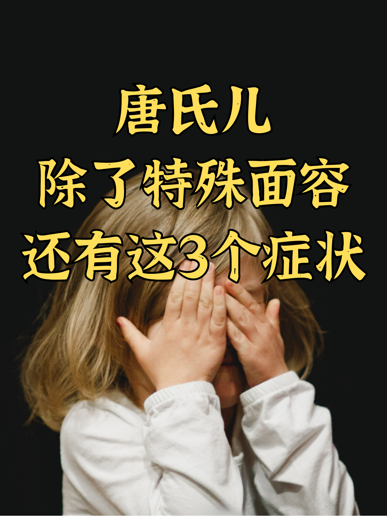 认识唐氏儿!