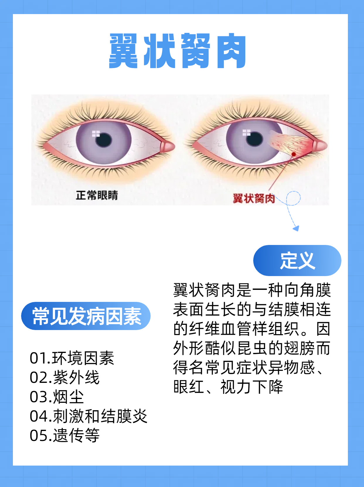 翼状胬肉手术费用解析 翼状胬肉手术费用因多种因素而异,包括手术方式