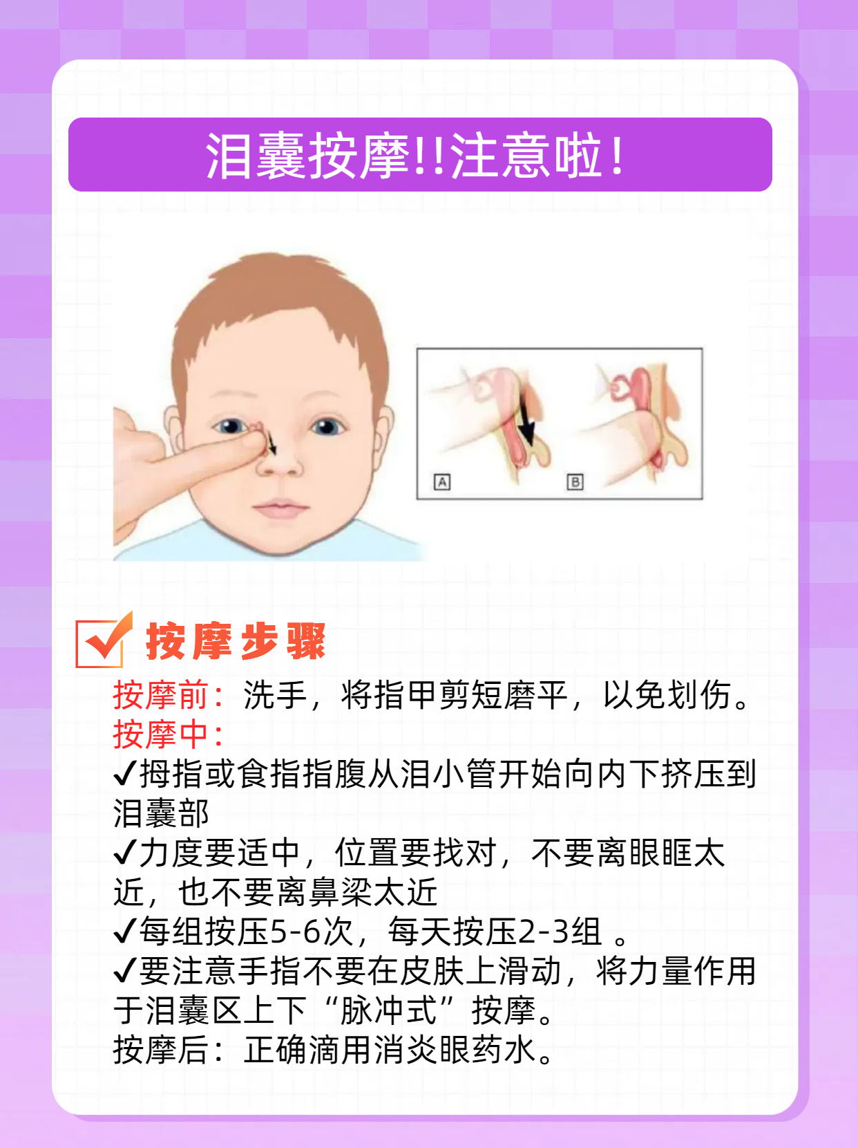 警惕新生儿泪囊堵塞 新生儿泪囊堵塞,是指新生儿泪道系统中的泪囊部分