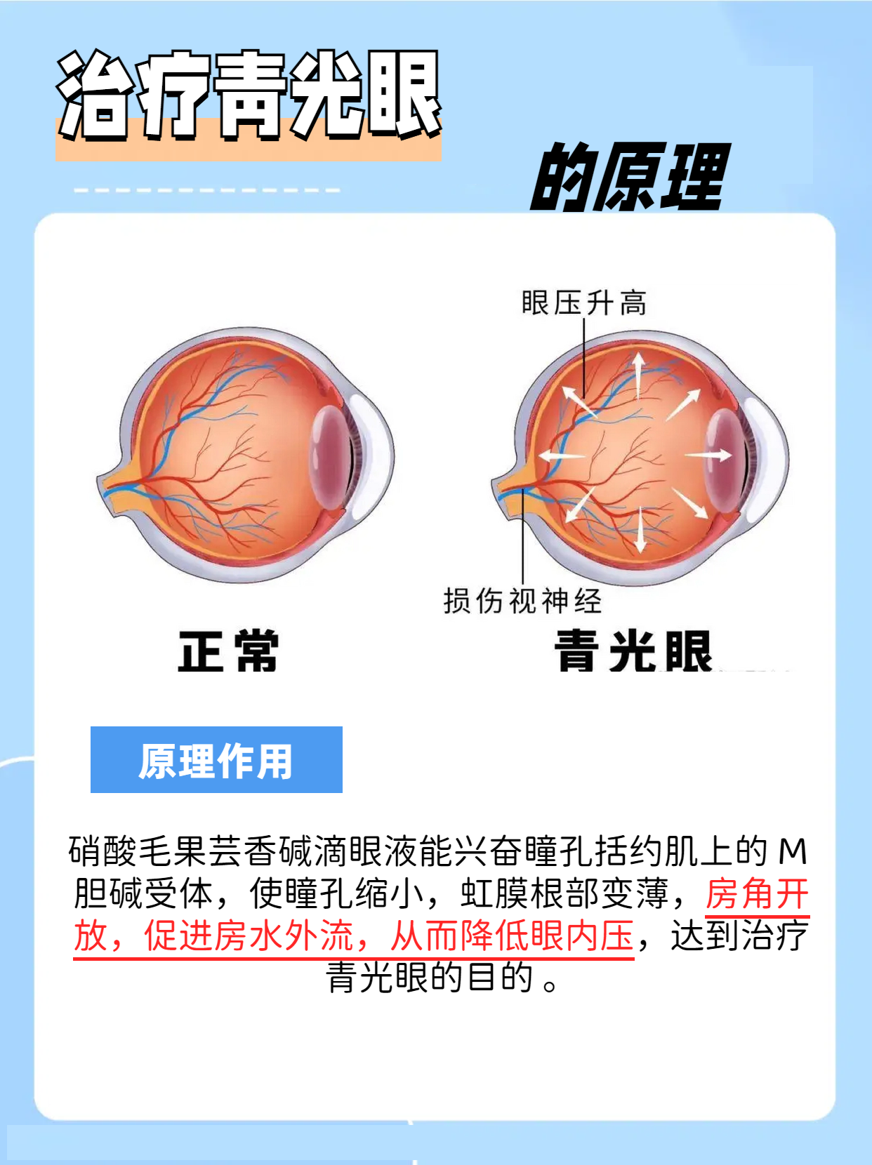 缩瞳药作用原理