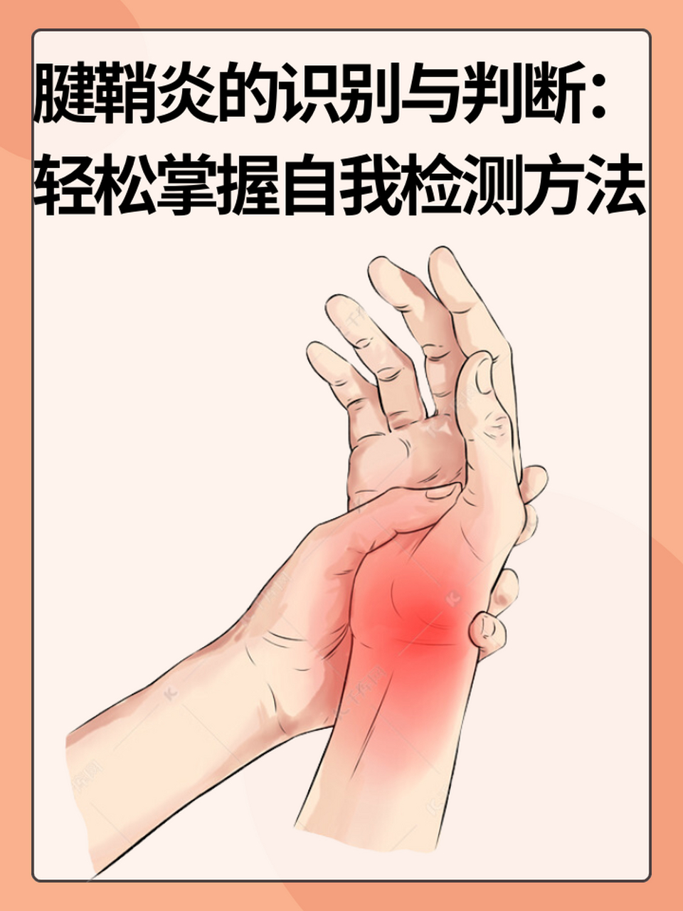 97腱鞘炎的识别与判断:轻松掌握自我检测方法 67腱鞘炎是一种常见