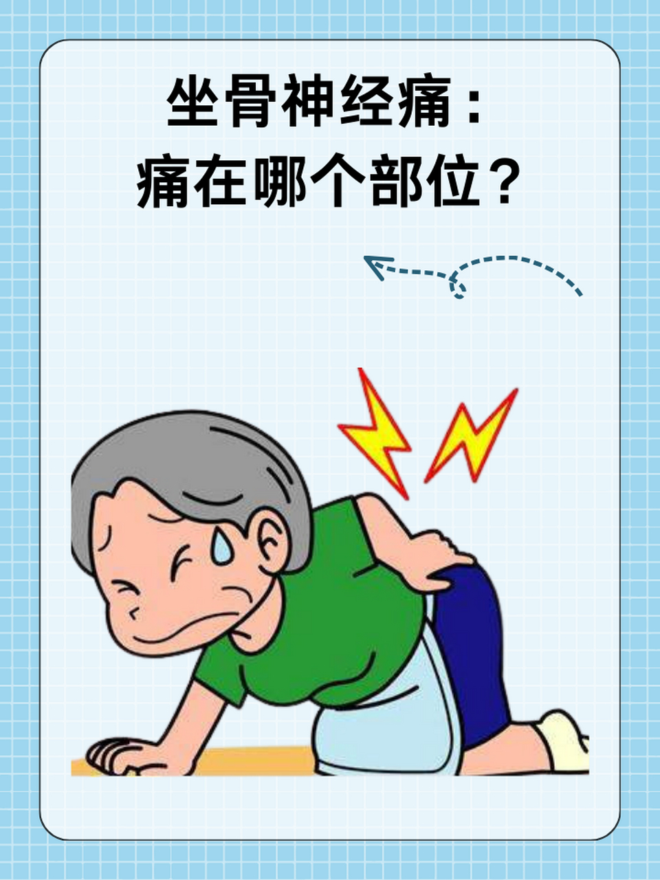 97坐骨神经痛:痛在哪个部位?