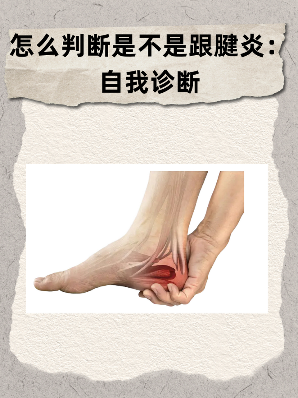 👉怎么判断是不是跟腱炎:自我诊断 ⏩跟腱炎是一种常见的运动相关