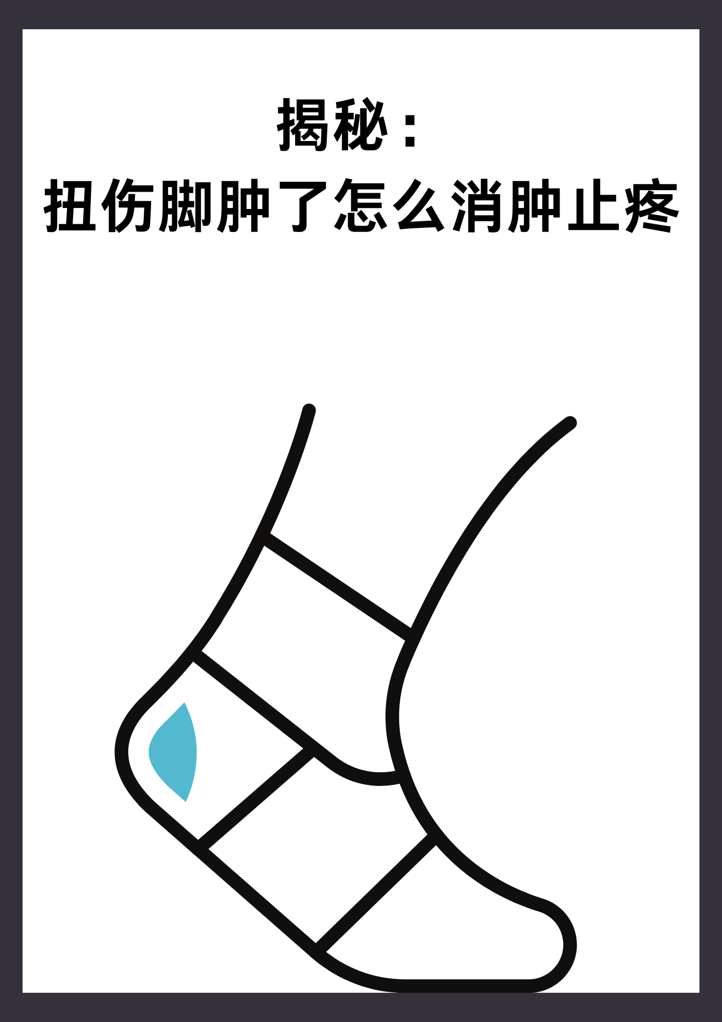 揭秘:扭伤脚肿了怎么消肿止疼