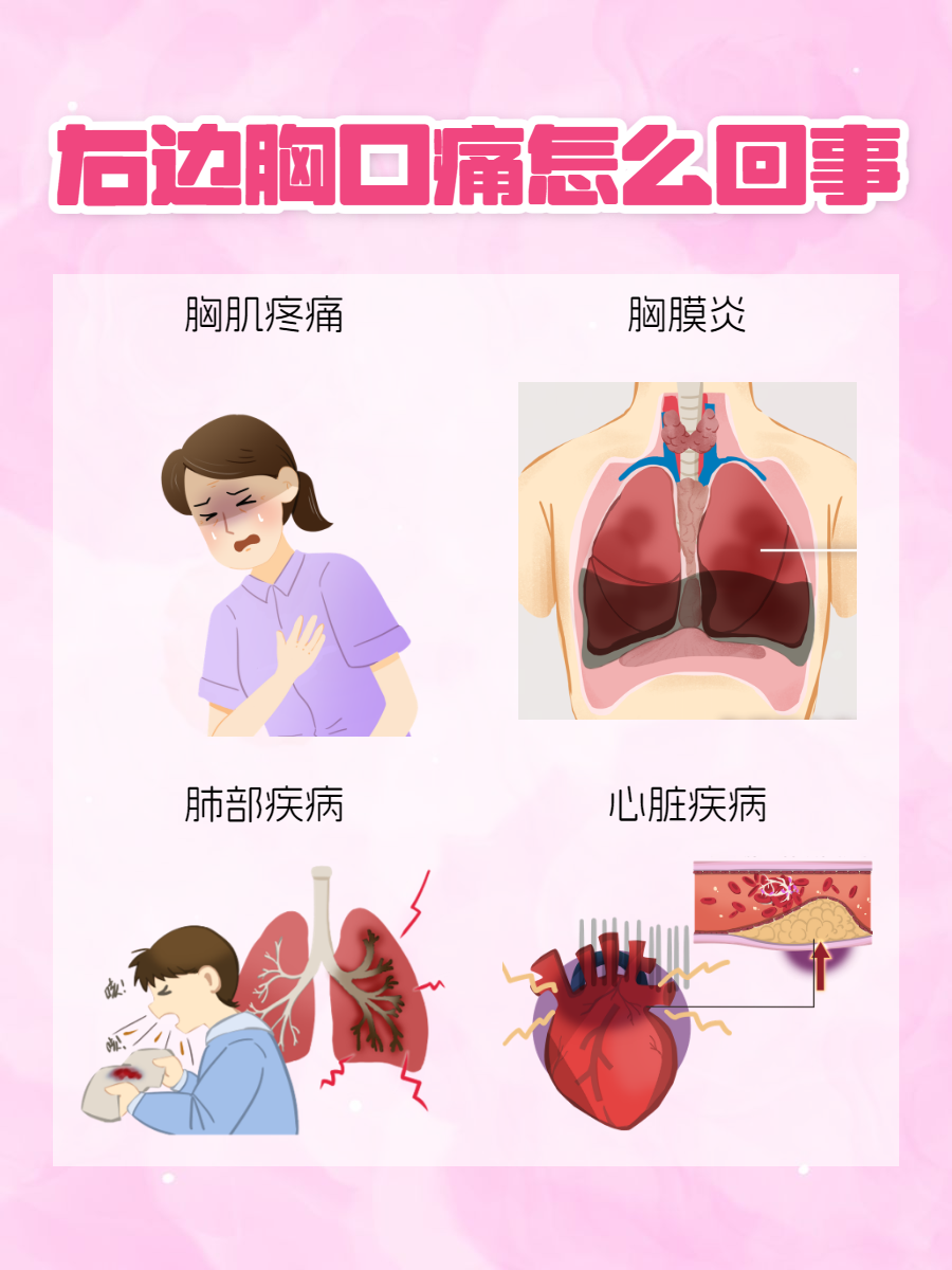 胸壁疼痛症状图片