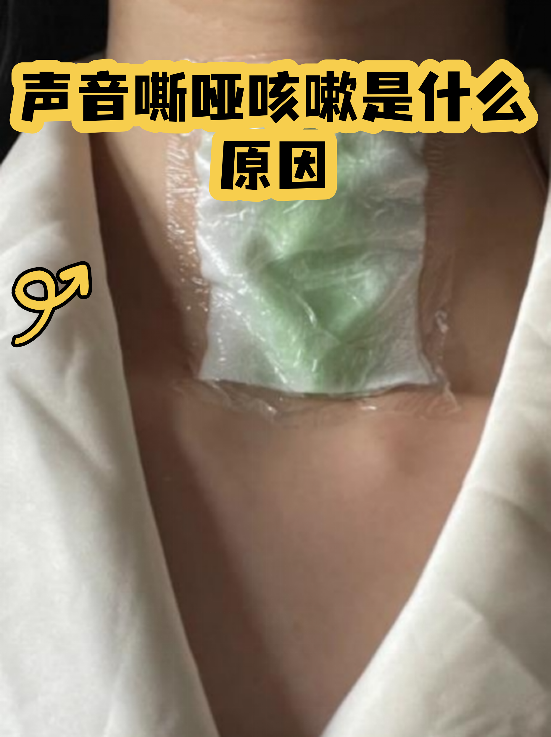  什么病会导致嗓子哑了(什么病能引起嗓子不舒服)