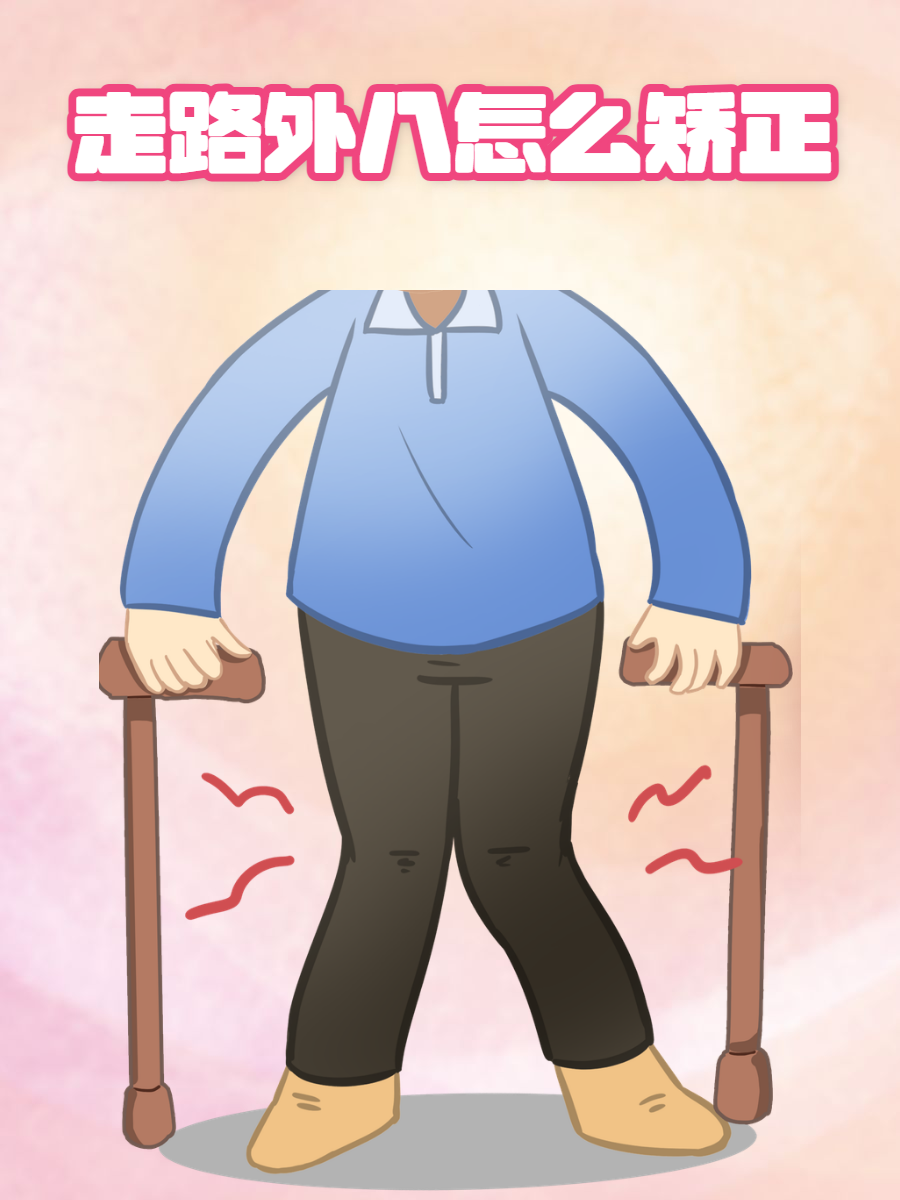 走路外八怎么矫正?