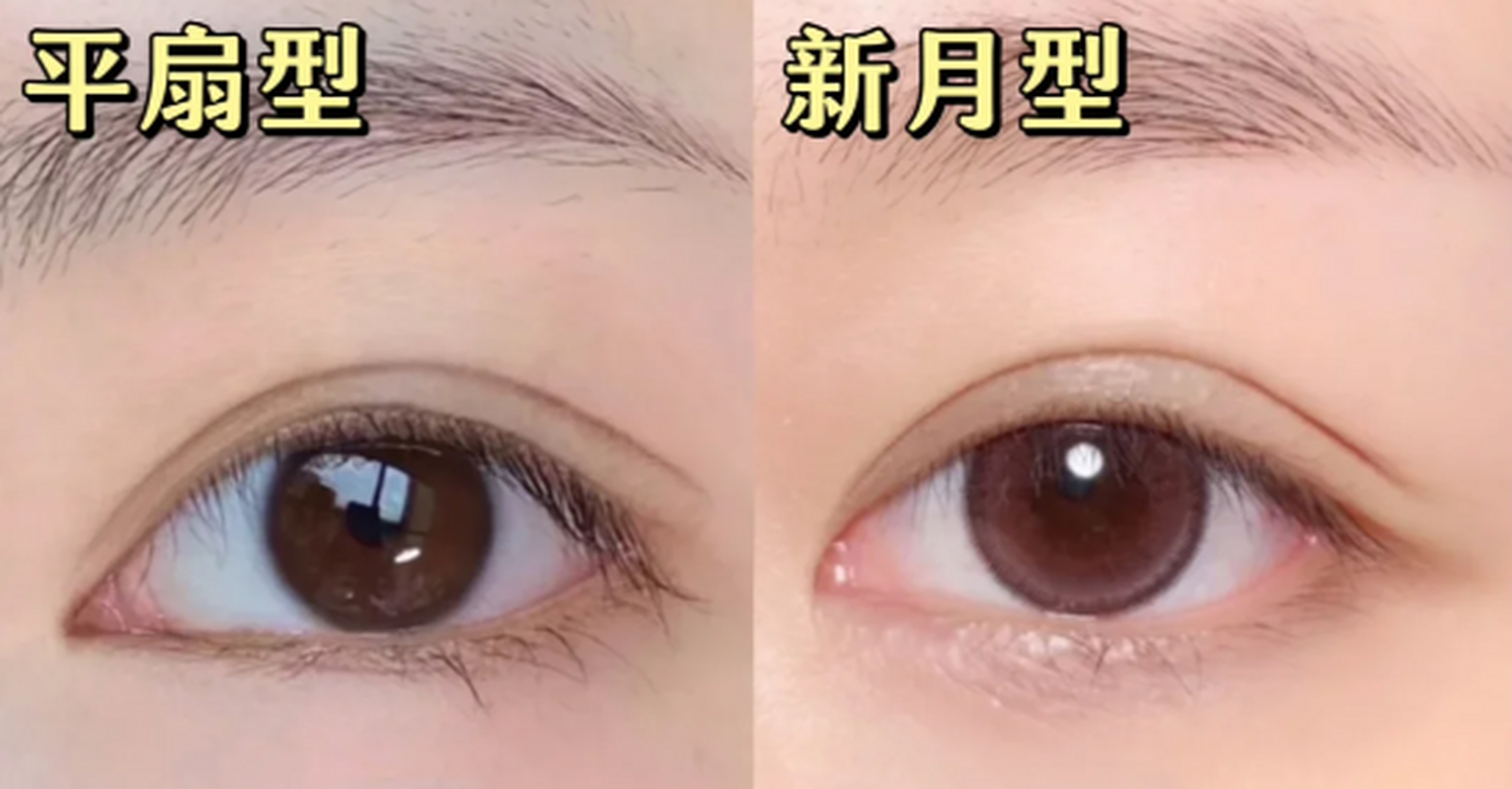 2,适合做什么形状的双眼皮?