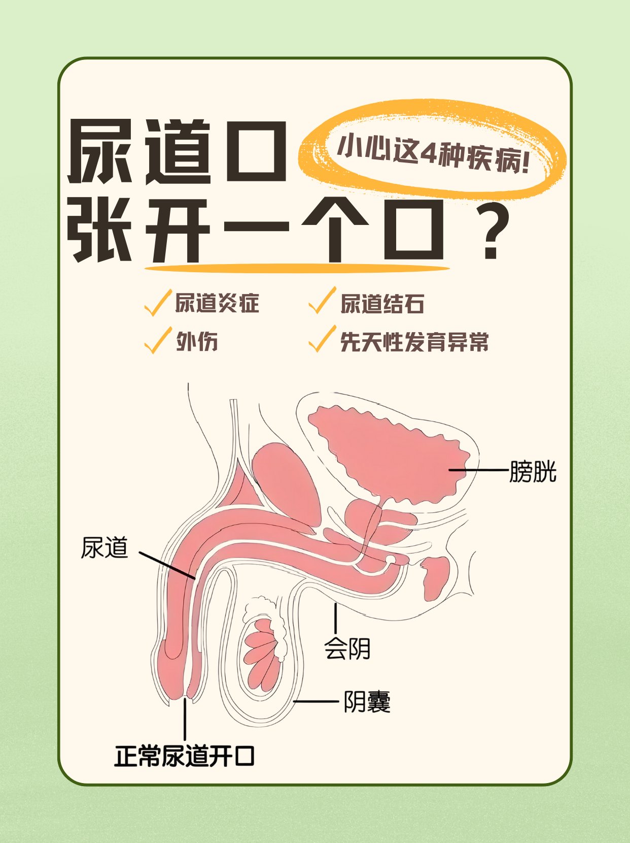 原因有4点 正常情况下,尿道口处于相对闭合状态,其大小和形态因人而异