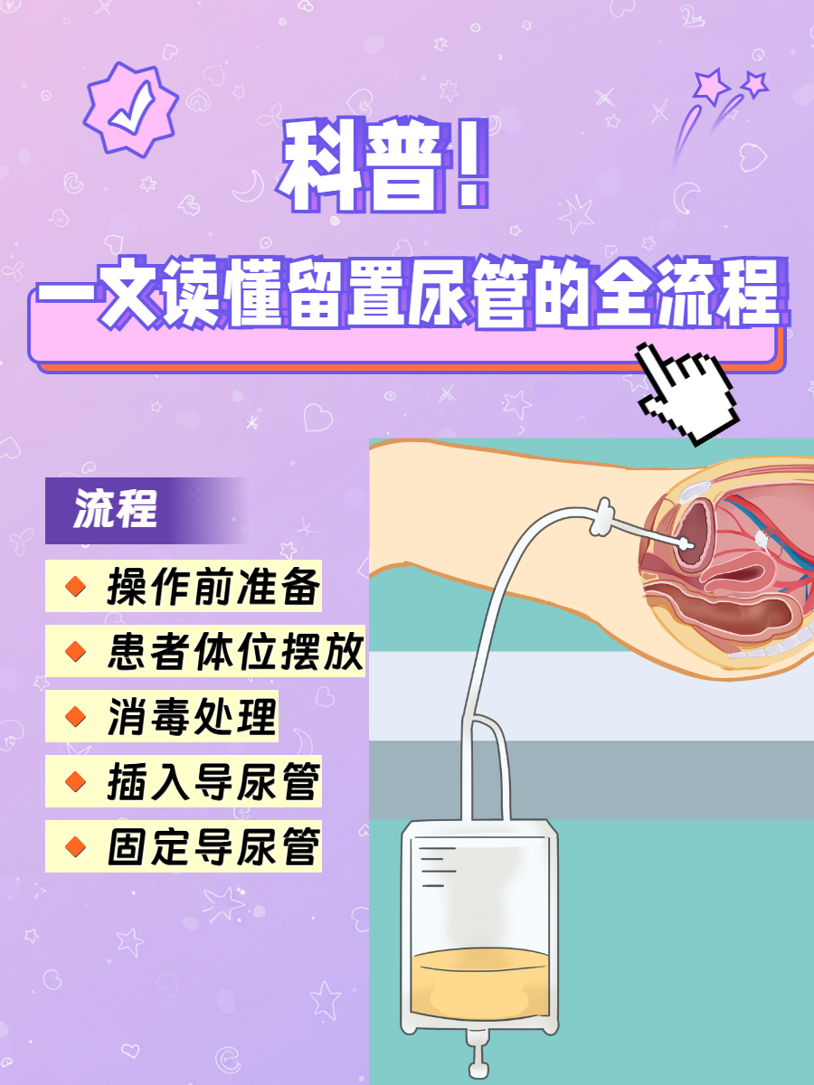 一文读懂留置尿管的全流程
