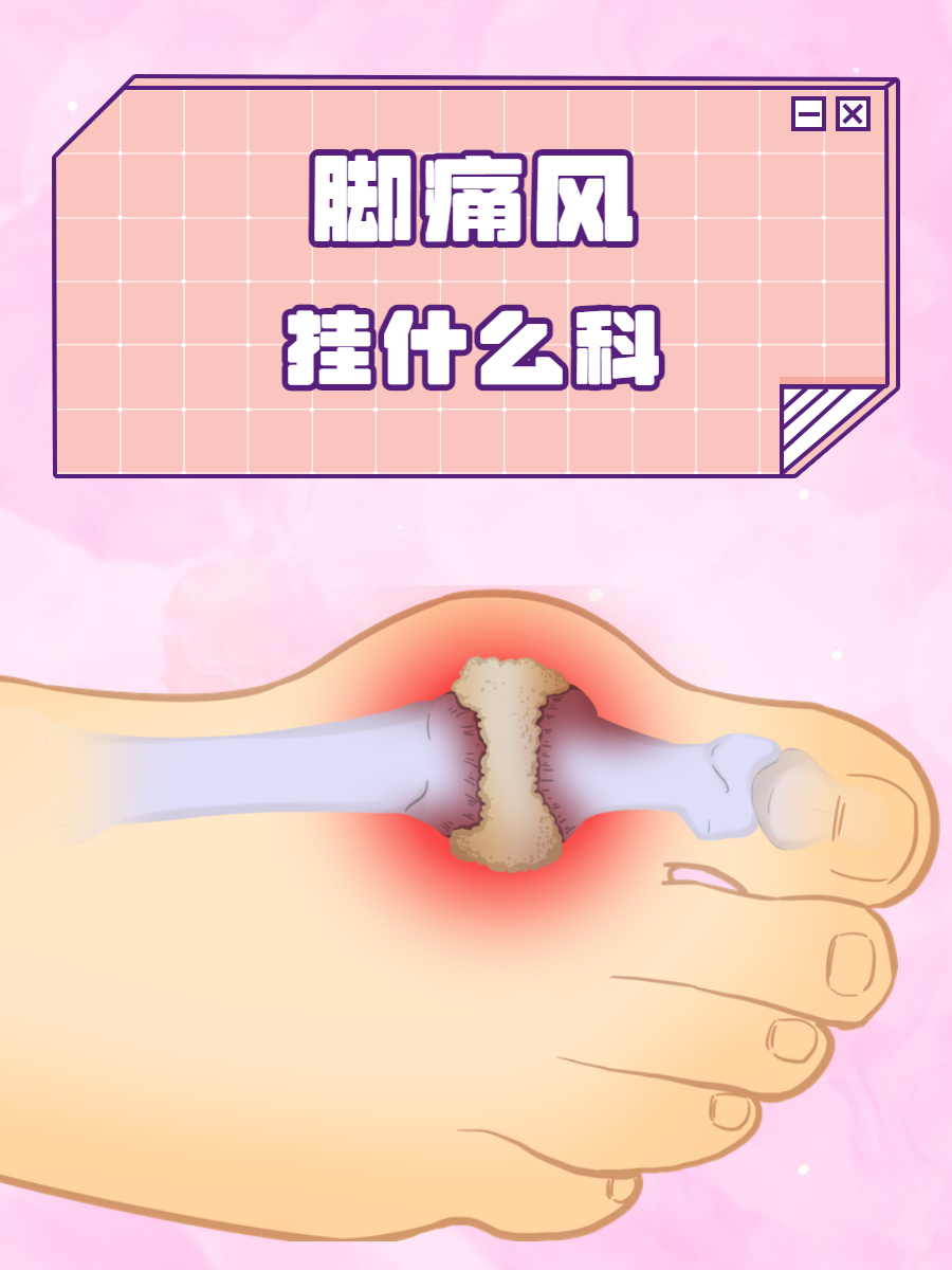 为什么得痛风的季节百科在线 为什么得痛风的季节百科在线