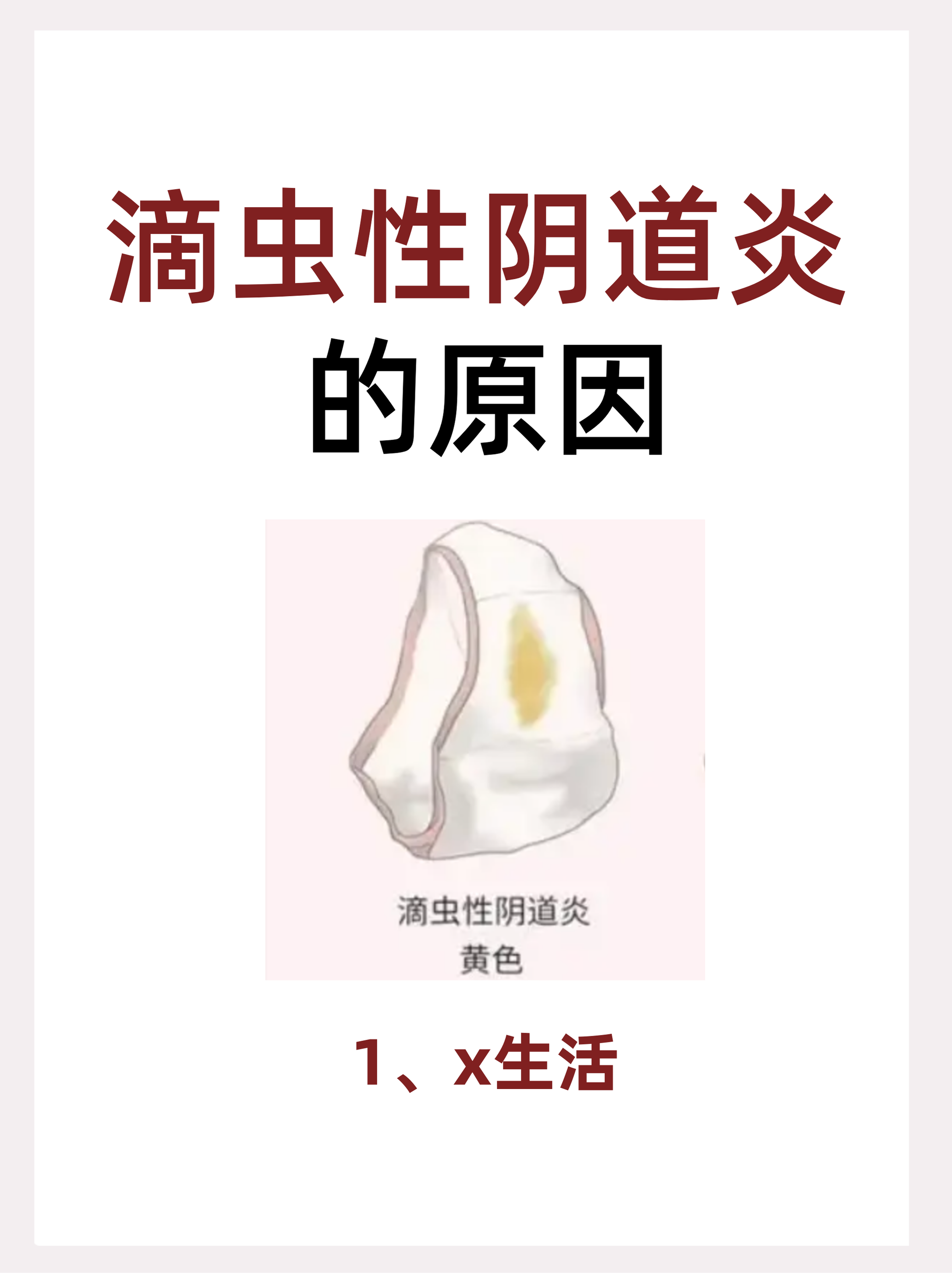 滴虫性阴炎是怎么感染上的?怎么治? 一,感染滴虫性阴.