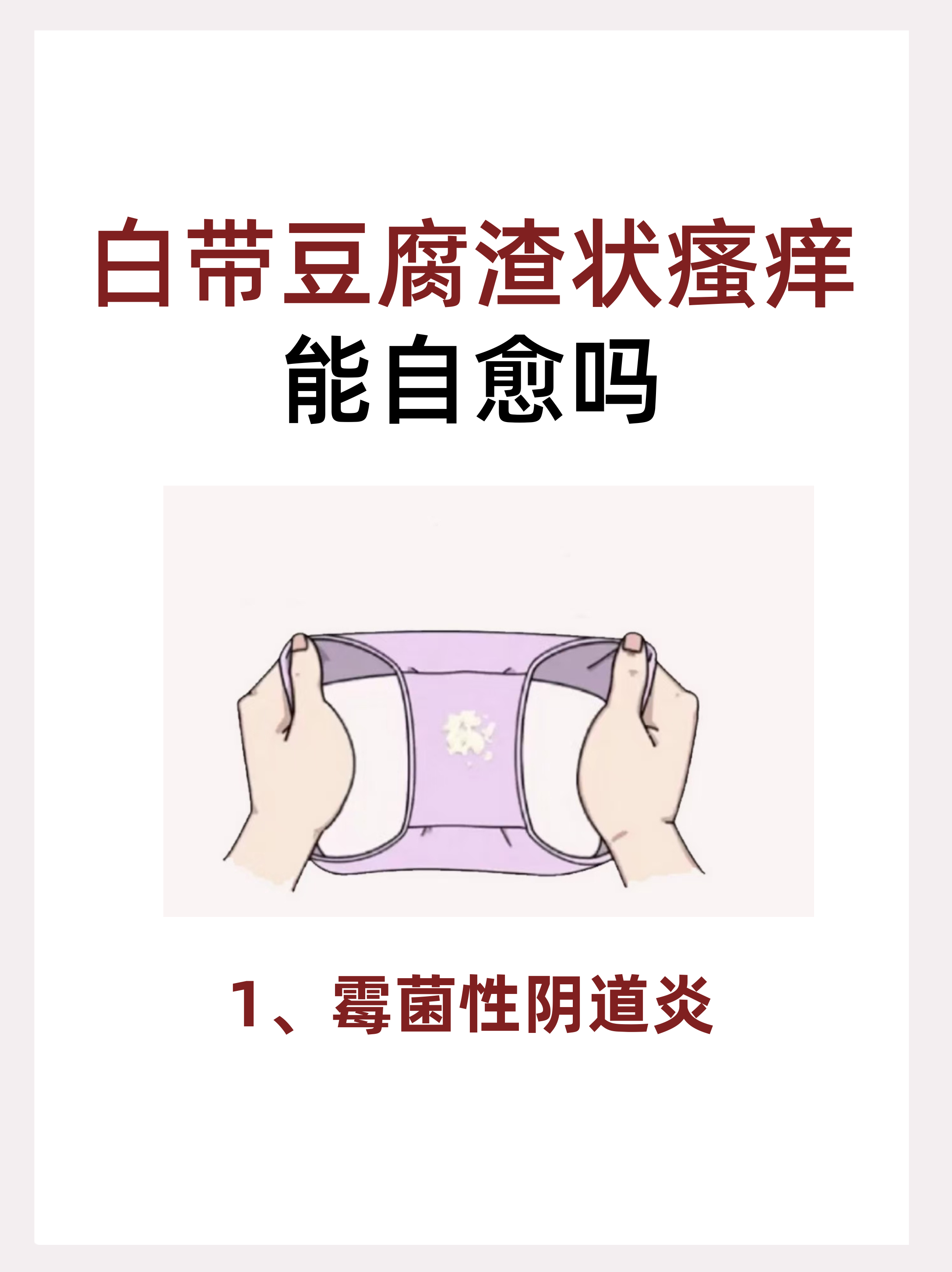 道炎的典型症状.霉菌性阴.道炎,主要是感染了白色念.珠.菌,白色念.珠