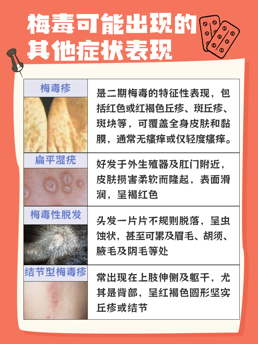 而梅毒硬下疳其实就是梅毒一期的典型表现,简单来说,就是梅毒螺旋体在