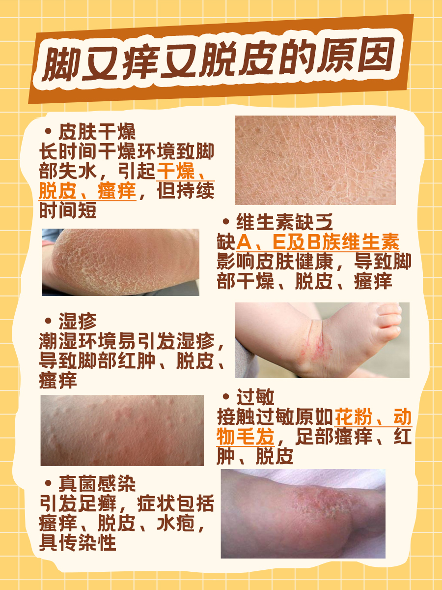 脚又痒又脱皮,你了解几种原因