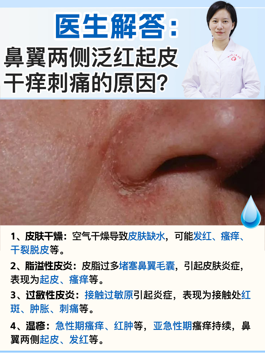 鼻子两侧发红还起皮怎么治疗鼻子两边红红的还脱皮是怎么回事鼻翼两边