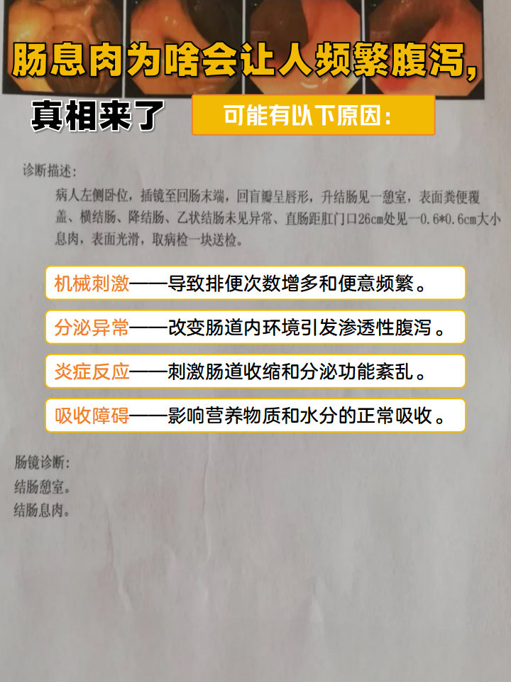 为什么会有肠息肉 为什么会有肠息肉