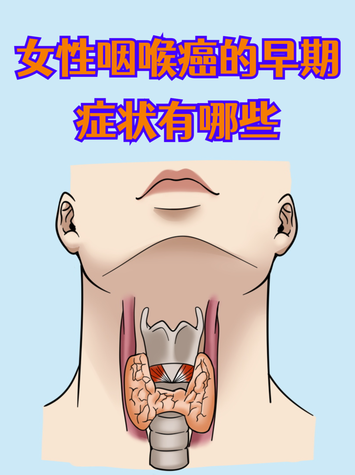 女性咽喉癌的早期症状有哪些