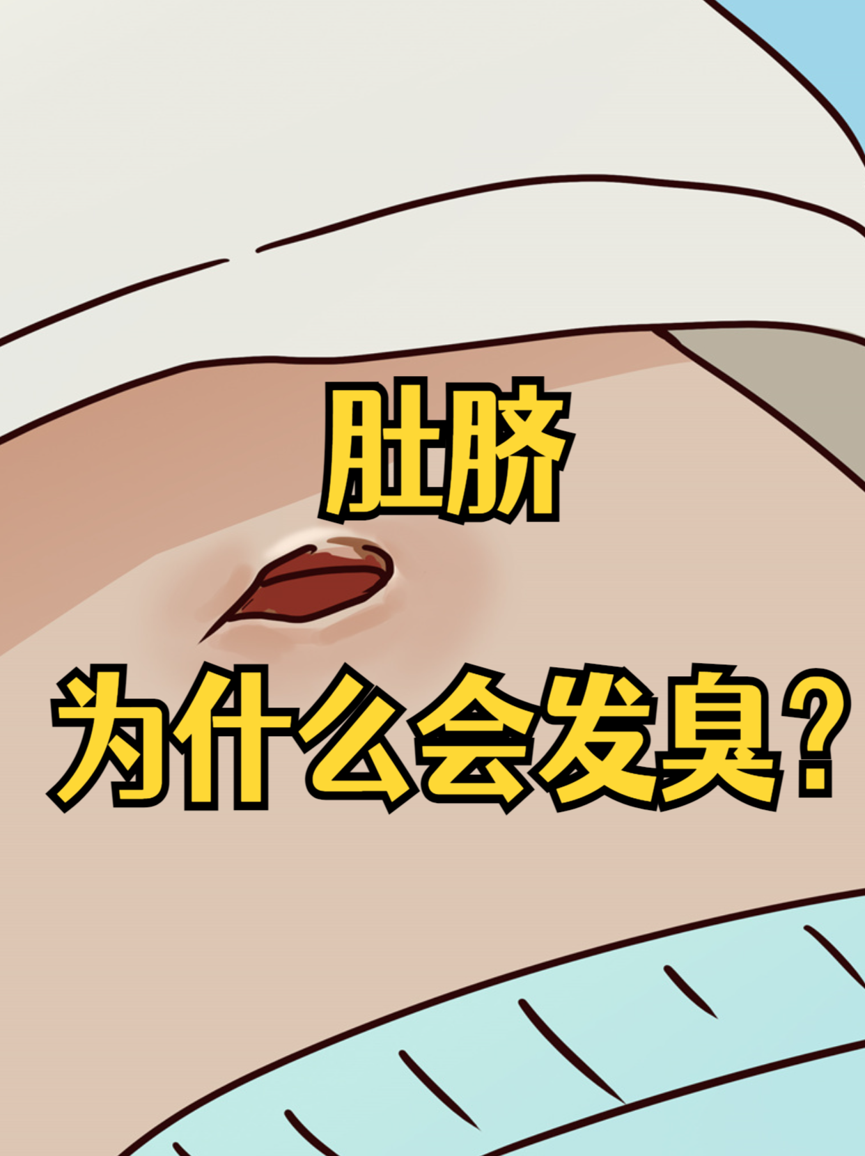 为什么肚脐眼里有脏东西