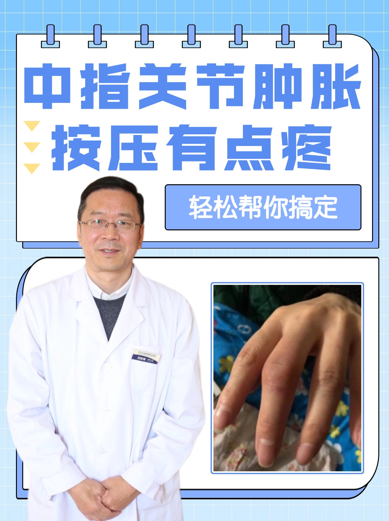 中指屈指肌腱腱鞘炎图片