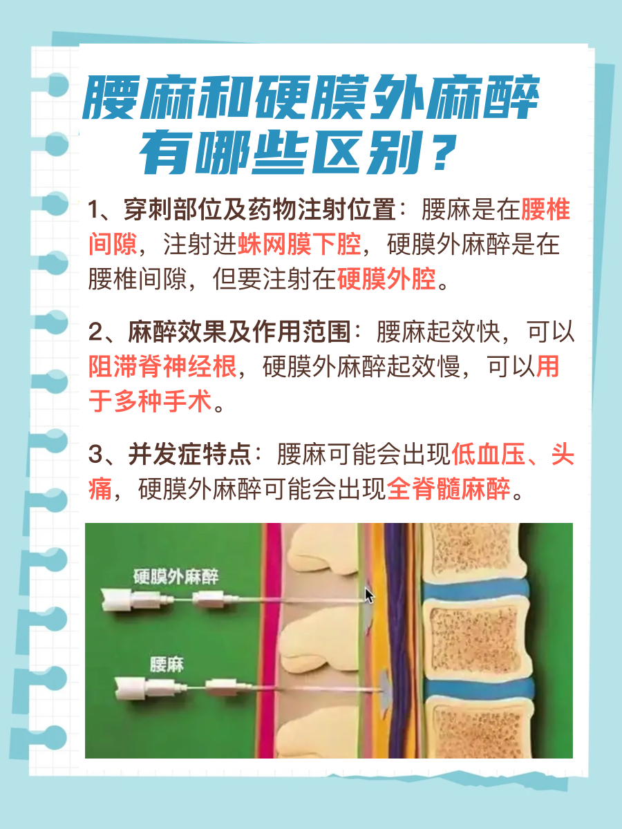 腰麻vs硬膜外麻醉,一文带你了解其区别!
