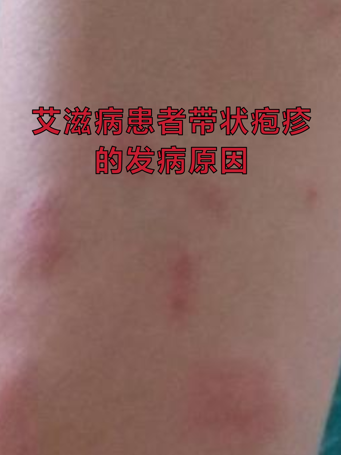  最近流行病毒什么病什么症状都没有(中国又出现一种新病毒)