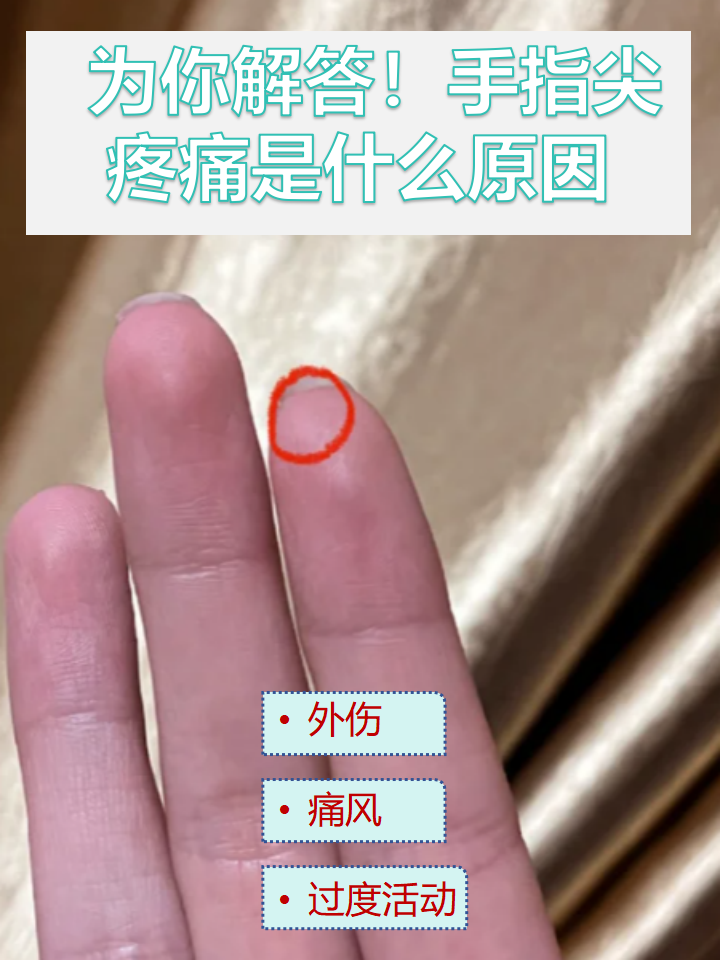 手指疼图片大全图片