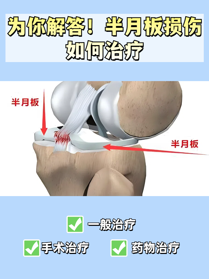 半月板损伤属于膝关节常见的损伤之一,是指半月