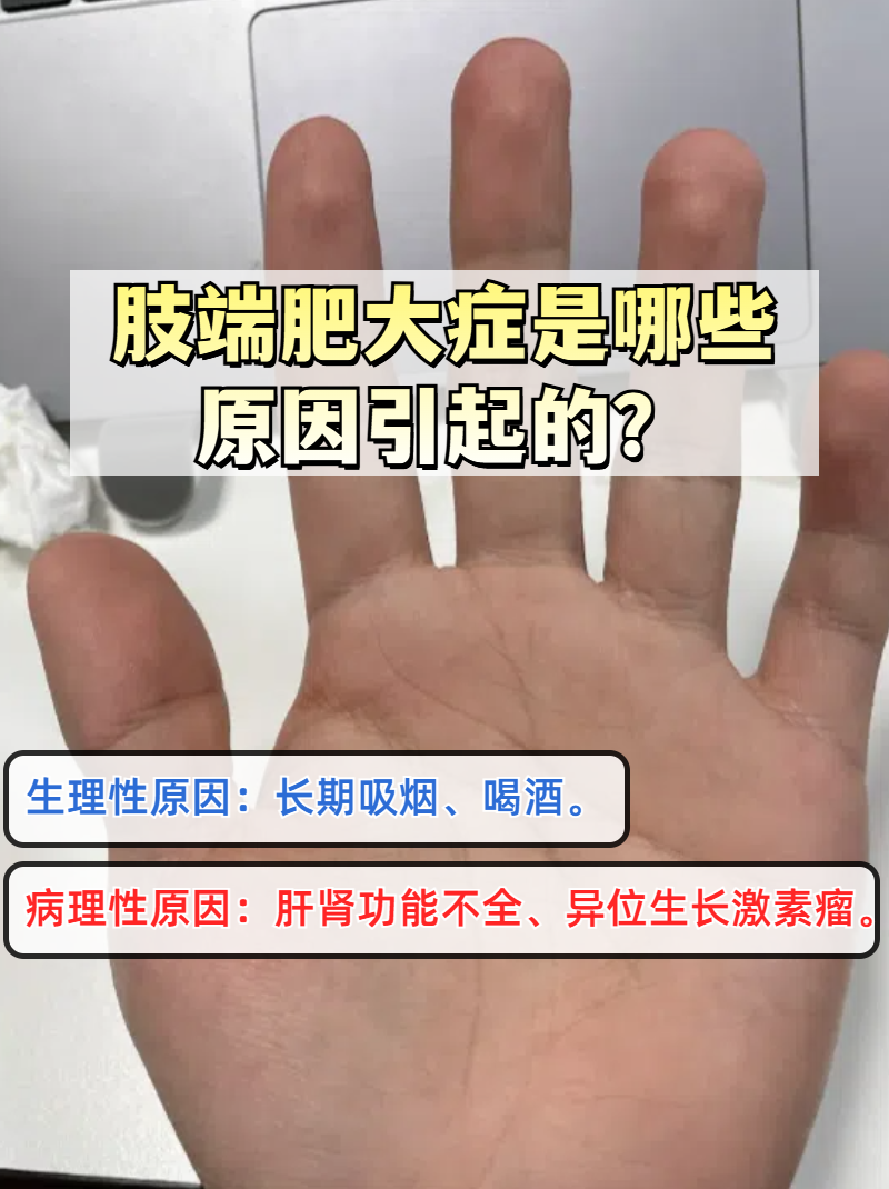 肢端肥大症是哪些原因引起的?