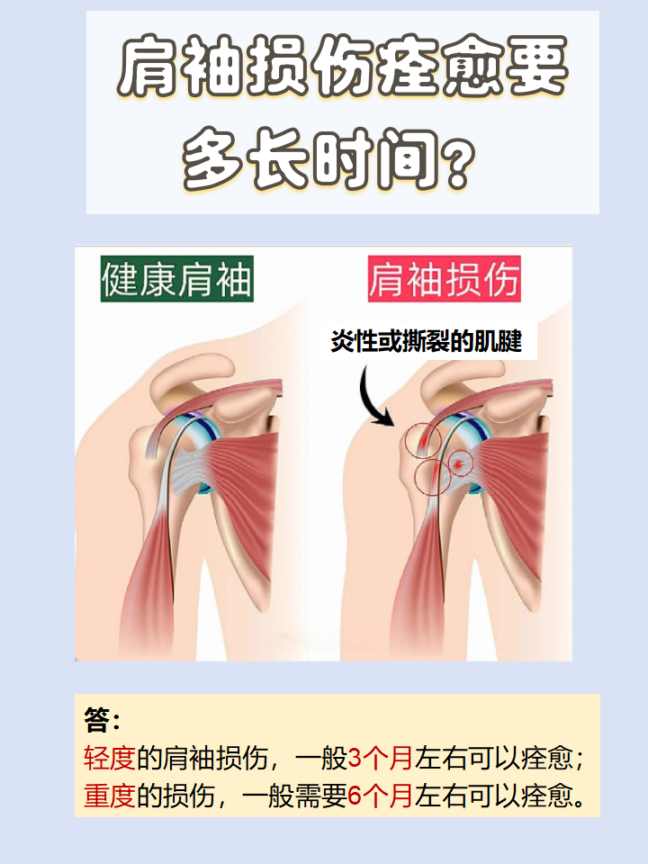 肩袖炎疼痛位置的图片图片