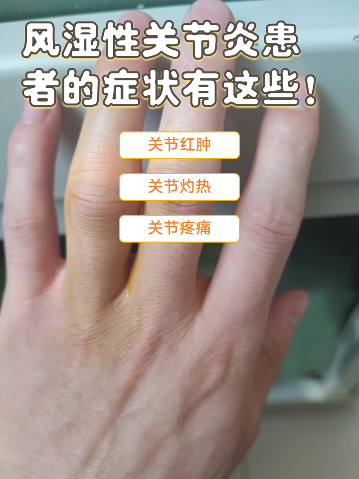 风湿性关节炎患者的症状有这些!