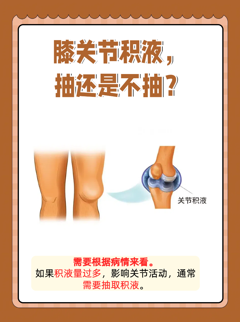这可能就是膝关节积液,一个让人头疼的问题.但别担心,我来给你支招!