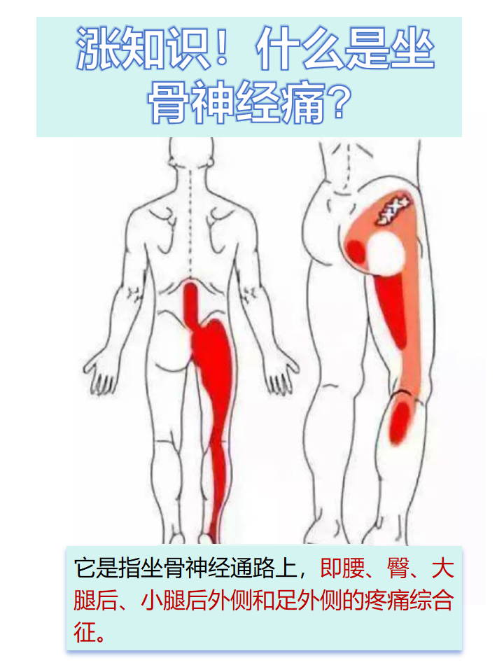 坐骨在哪里位置图图片