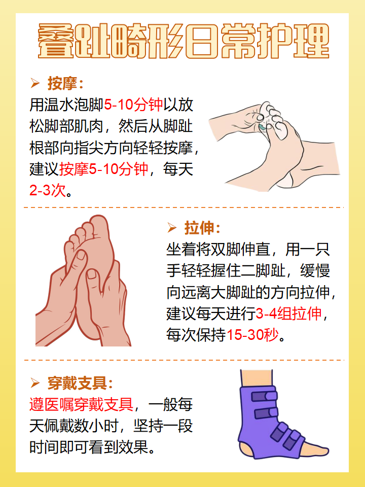 大家知道叠趾畸形吗?指的是一趾与相邻足趾叠加的足趾畸形.