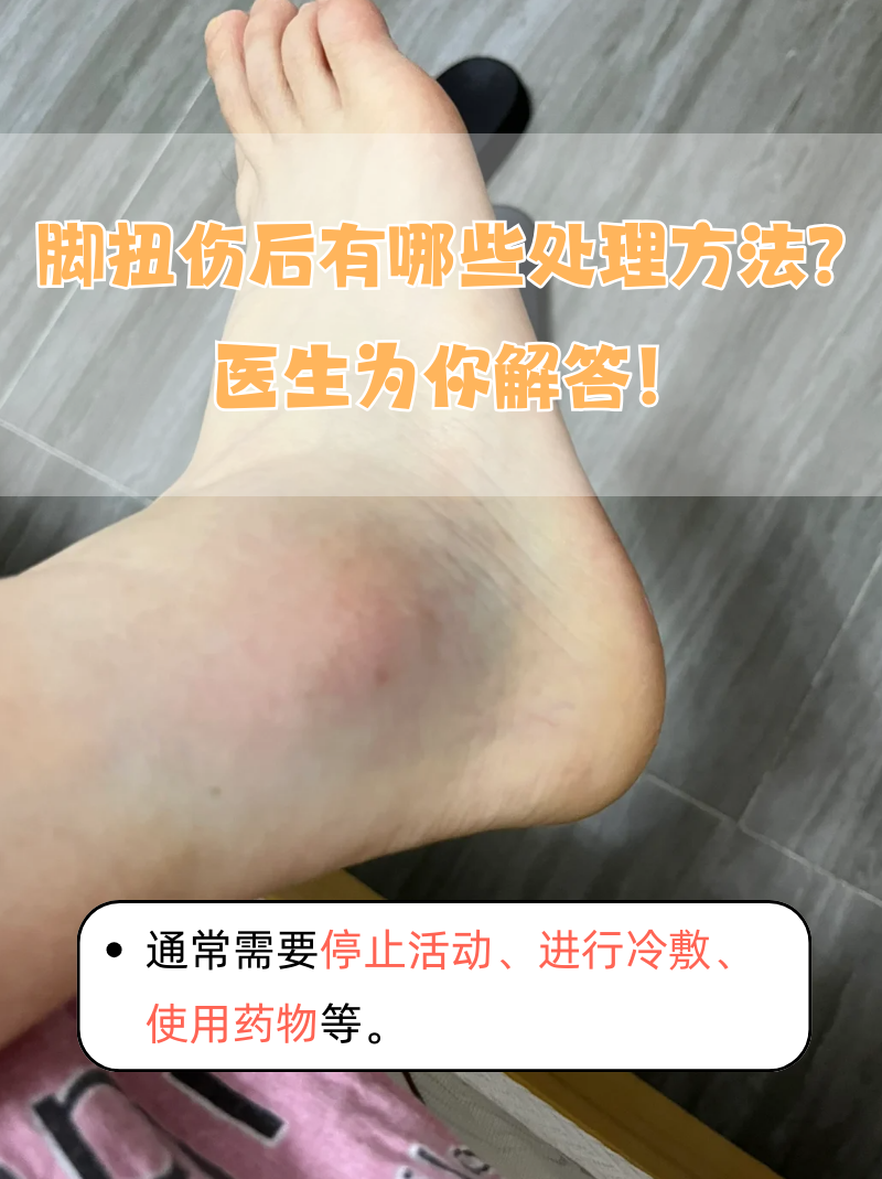 脚扭伤后有哪些处理方法?医生为你解答!