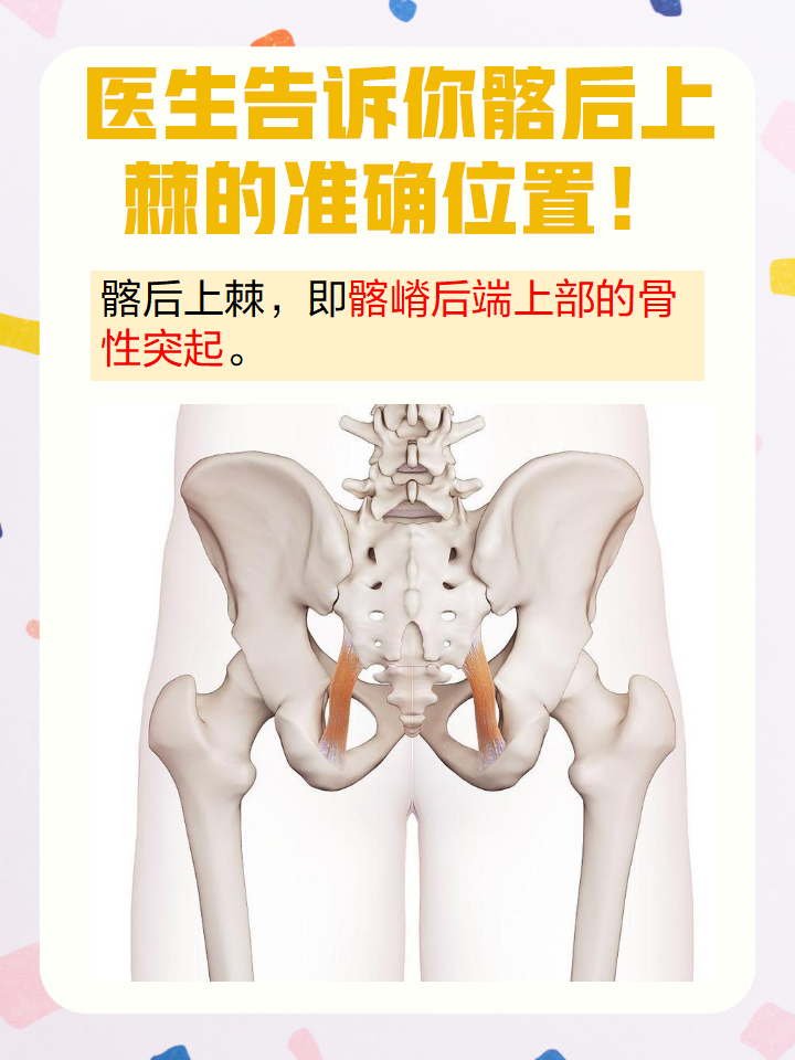 它是髂嵴后端上部的骨性突起,位于骨盆髂骨后面,左右各有两个,通常在