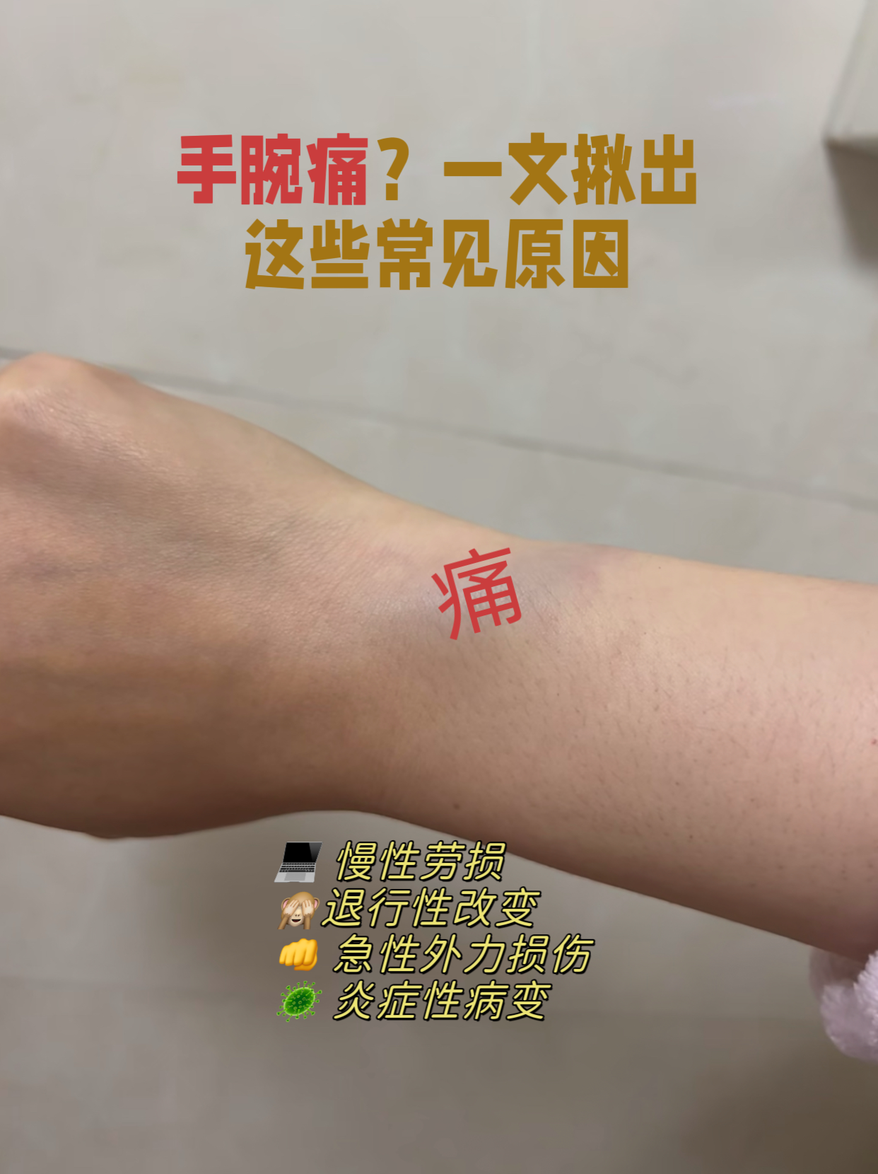 手腕疼的图片腕关节疼痛手腕痛手腕腱鞘炎的症状有哪些手腕疼痛的原因