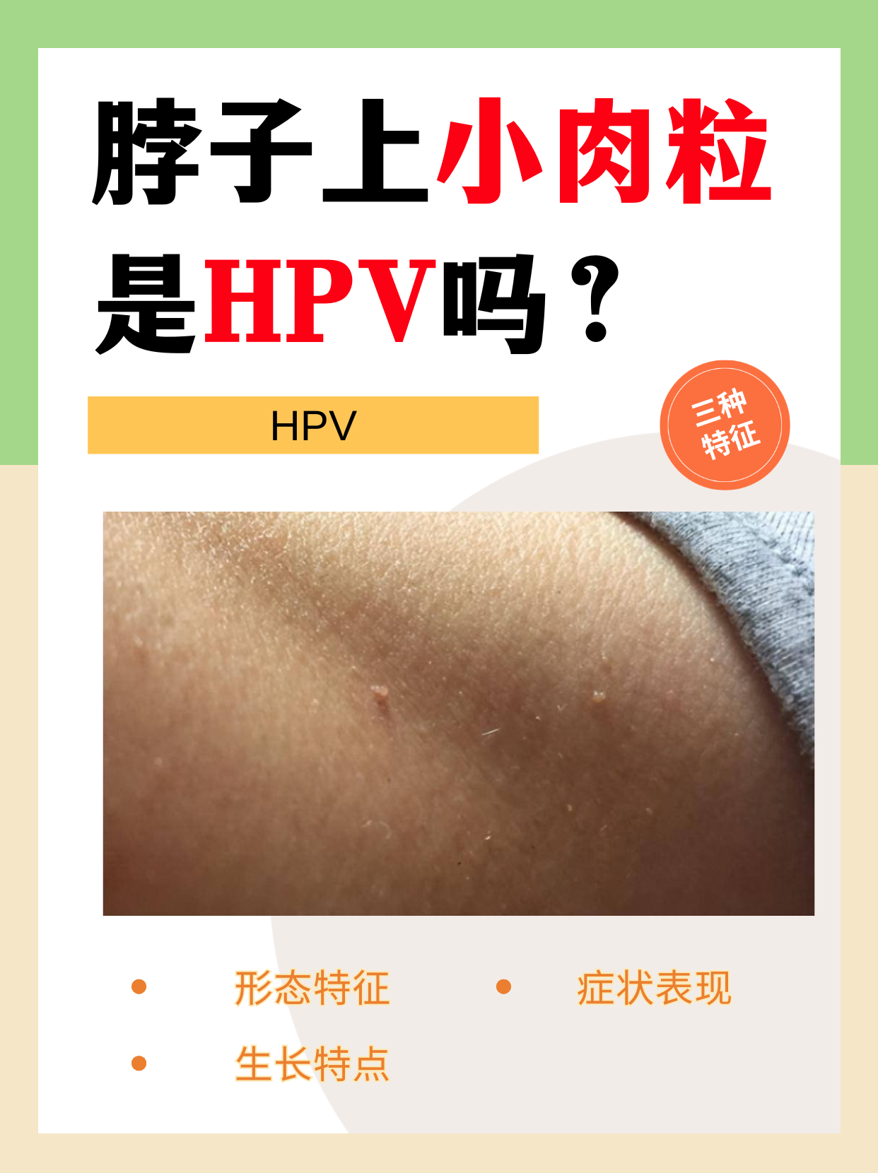 脖子上小肉粒是hpv吗?有这3种特征才是病毒疣!