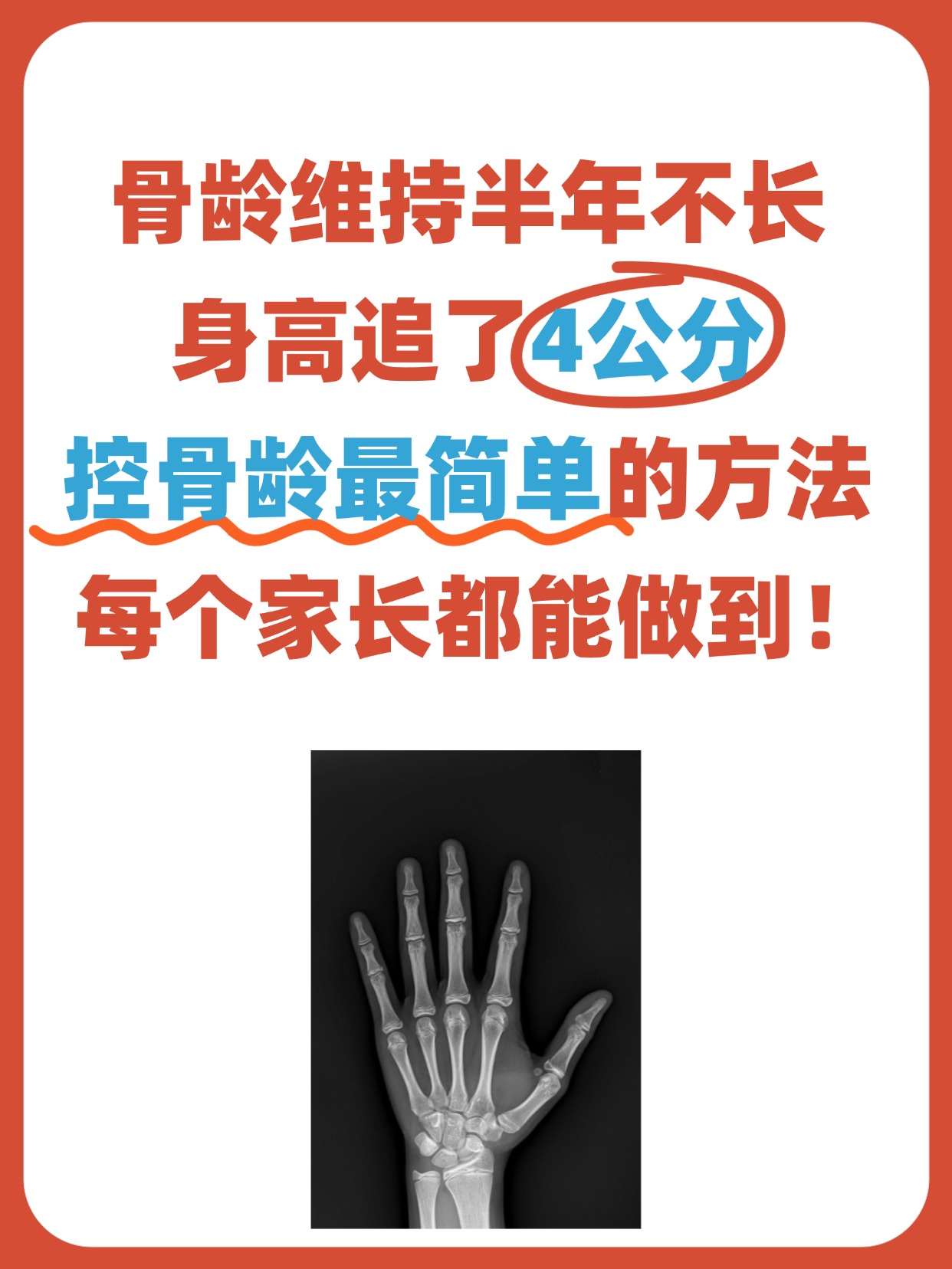 骨龄半年不长身高追了4公分控制骨龄最简单的方法每个家长都能做到