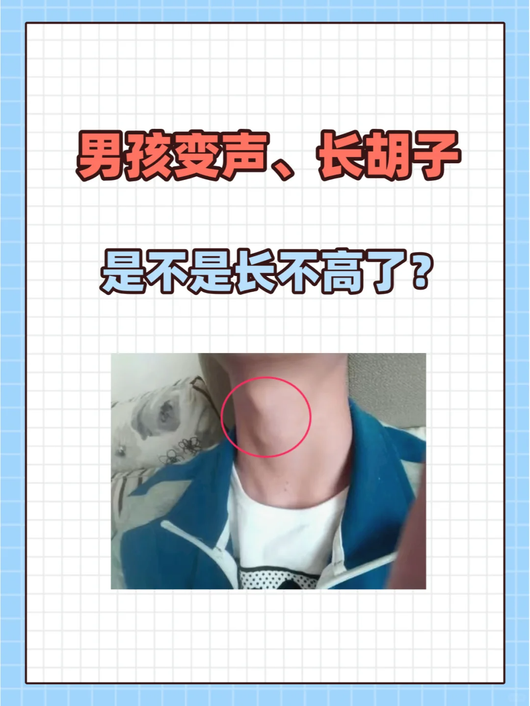 16岁开始出现发育迹象,如果14岁之前就出现喉结