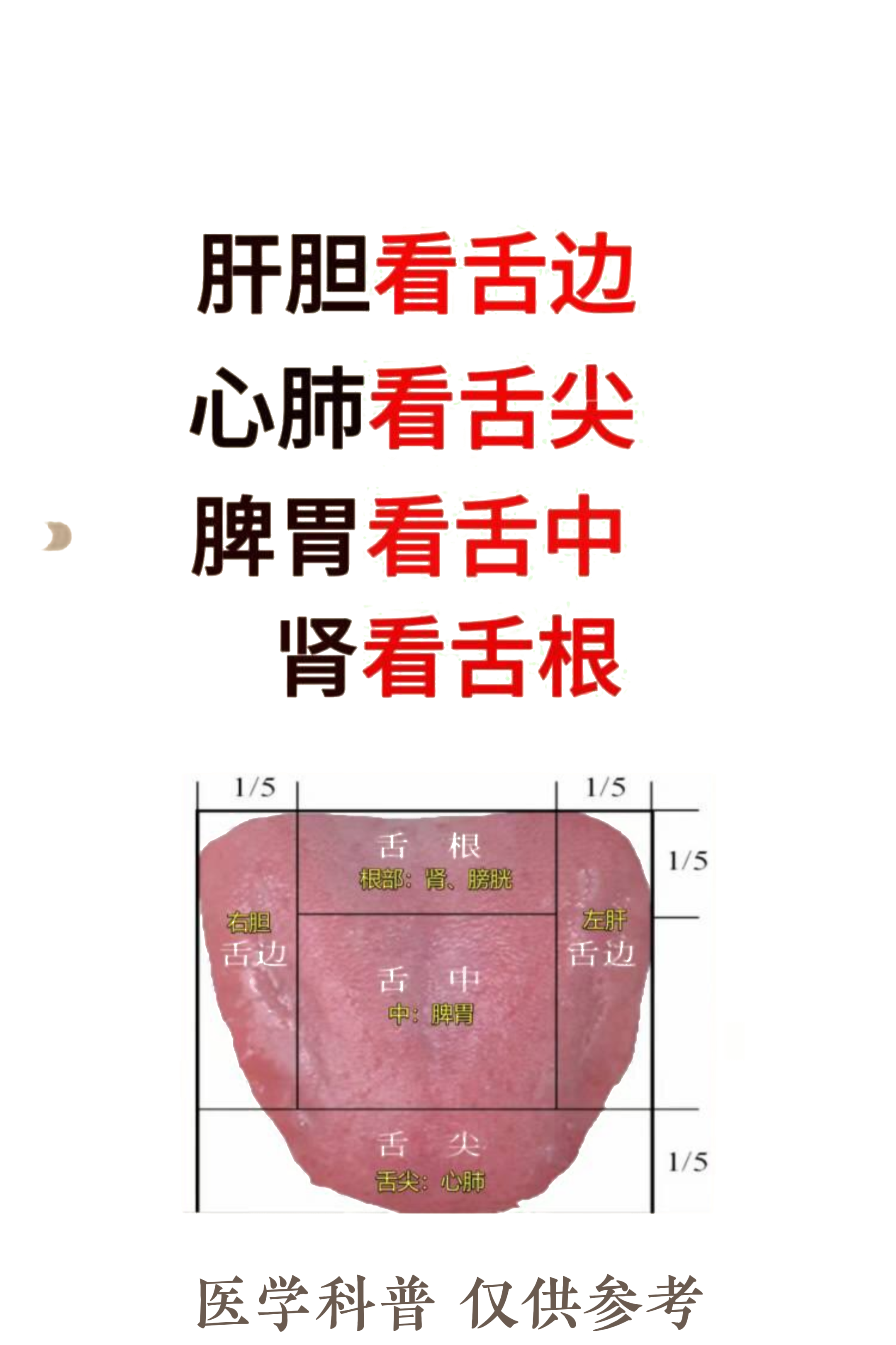 中医舌头看病图解图片