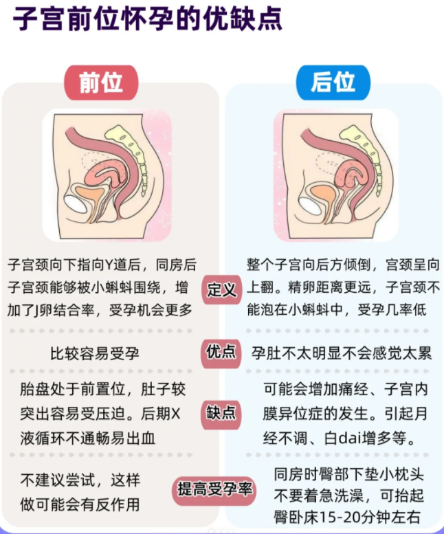 子宫后位指的是子宫体向后倾斜,子宫颈向上翘起的状态,这是子宫位置的