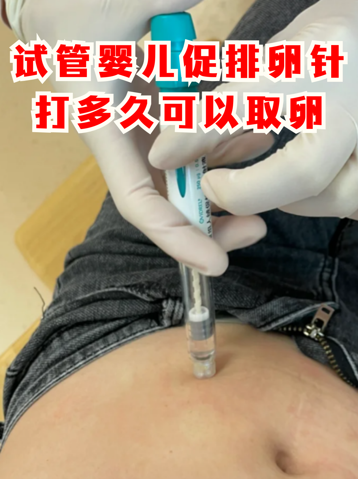 取卵 第107页