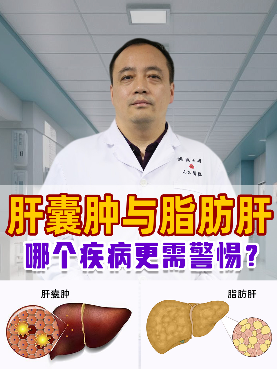 肝囊肿与脂肪肝:哪个疾病更需警惕?